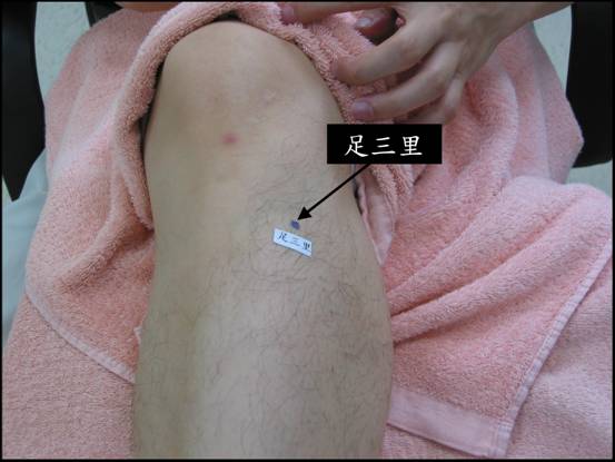 剖腹产后自我保健常识大集合